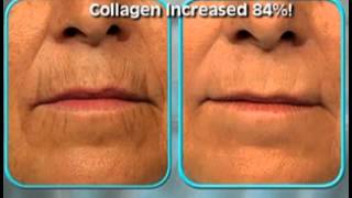 Stem Cell Skin Care