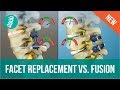 Facet Joint Replacement Vs. Spine Fusion