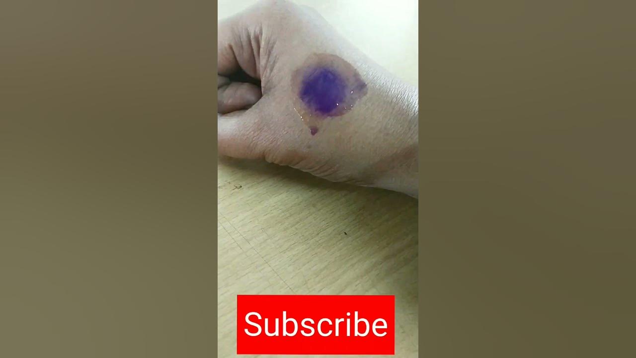 o-how-to-remove-pen-stain-useful