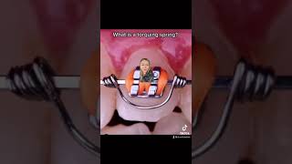 A torquing spring #shorts #braces #orthodontist #teeth