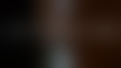 Managing a Dislocated Intraocular Lens by Anterior Capsule Haptic Fixation: a new original technique