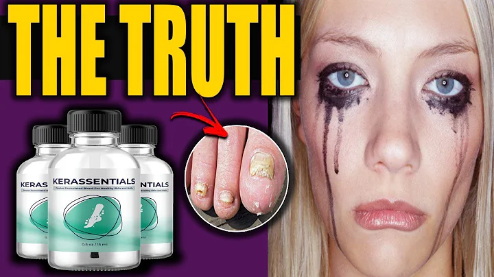 Kerassentials (( BE CAREFUL!))  Kerassentials Revi...