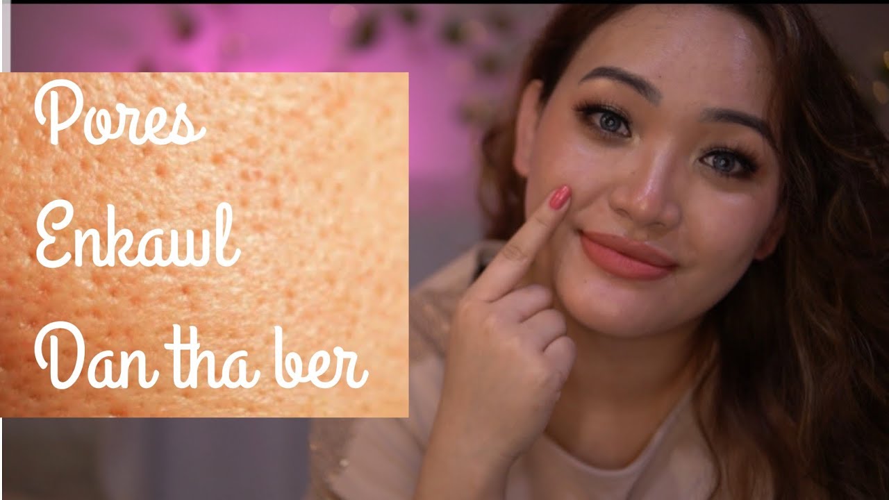 Vunkua | Pores enkawl dan| dr Nancy Lalnunpuii| Mizo dermatologist