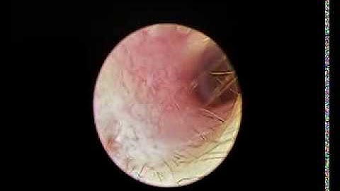 CCD camera F18mm with OD2.7mm firber optical rigid scope-Ear