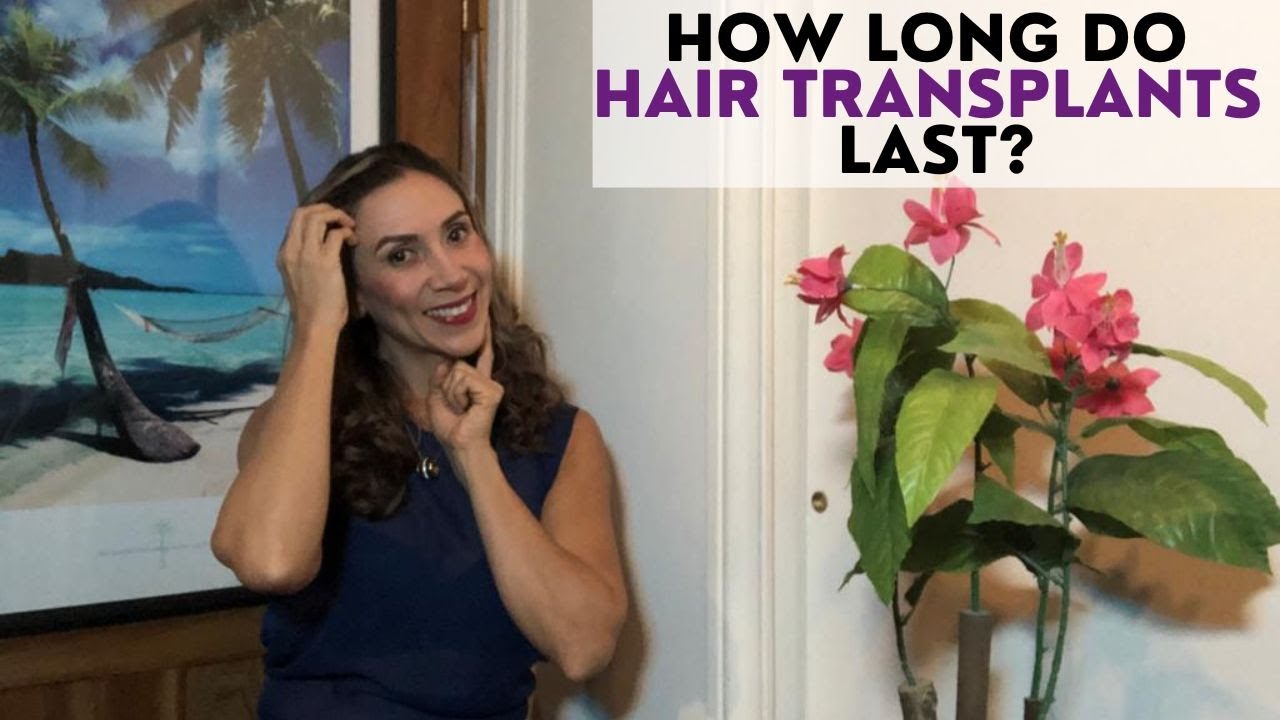 How Long Do Hair Transplants Last YouTube