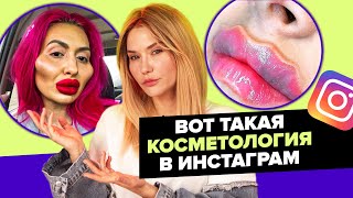 ПРОЩАЙ ЛИЦО! | Трэш косметология в инстаграм