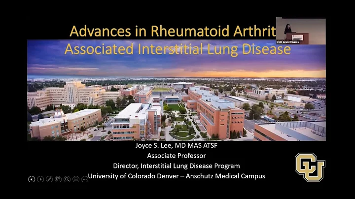 Advances in Rheumatoid Arthritis associated Interstitial Lung Disease