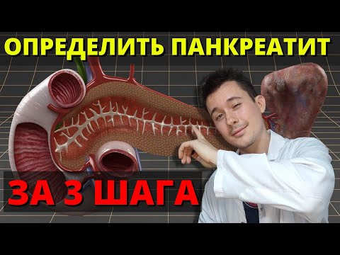 Панкреатит | Симптомы | Диагностика панкреатита