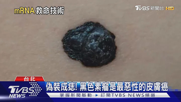 莫德納疫苗技術 成功降低「這致命癌症」復發率 癌症疫苗不遠了?｜十點不一樣20221221@TVBSNEWS01 - 天天要聞