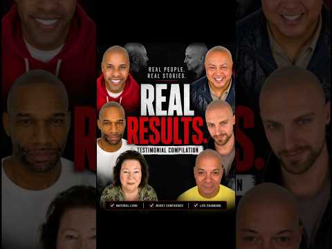 The Hair Loss Solution Nobody Told You About #scalpmicropigmentation #hairlosssolution #smp