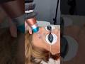 Green eyebrow tattoo removal / picosecond laser #lasertattooremoval