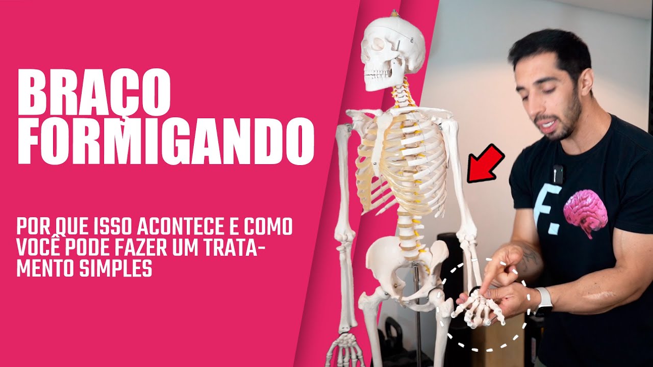 O que está te causando formigamento no braço | Pode ser sério - YouTube
