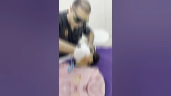 Radiant Skin Unveiled: Lumecca IPL Treatment Experience