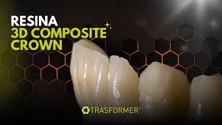 Resina Stampa 3D Composite Crown
