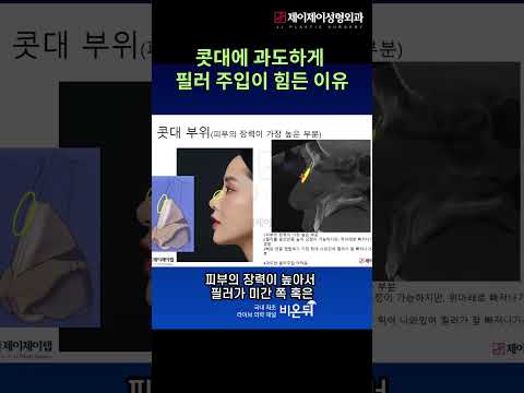 콧대에 과도하게 필러주입이 힘든 이유#<strong>필러</strong> #shorts