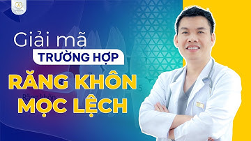 Giải Mã Phân Tích Trường Hợp Răng Khôn Mọc Lệch | Bác sĩ Trung Long Biên