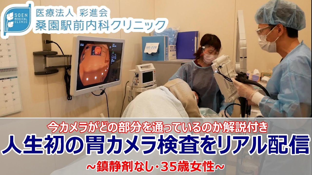 胃カメラ内視鏡検査】人生初の胃カメラ検査をリアル配信 ～鎮静剤なし