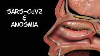 Loss of smell with a SARSCoV2 infection