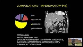 Mahesh B Malu | The Pancreatic puzzle : Radiologists role in in detecting pancreatitis complications