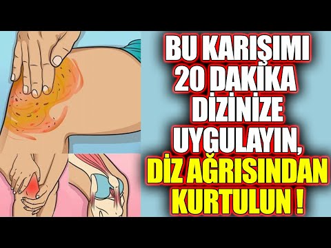 Bu Karışımı 20 Dakika Dizinize Uygulayın, Diz Ağrısından Kurtulun !