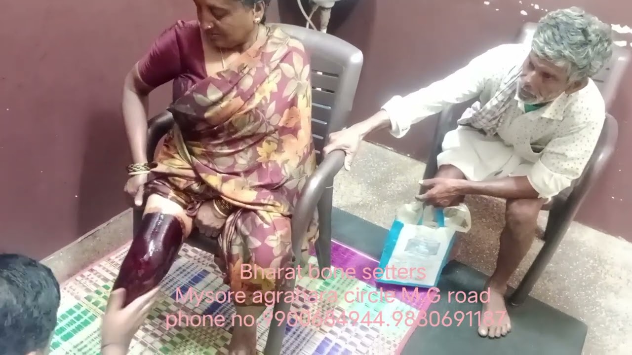 Bharat bone setters treatment