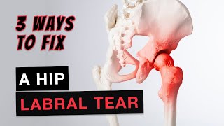 Hip Pain? Fix a Hip Labral Tear Fast