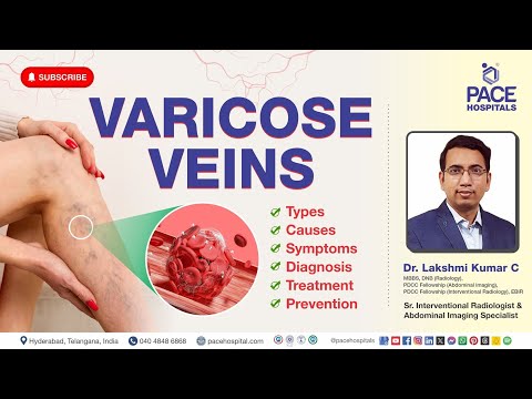 Video: Acute complications of varicose veins