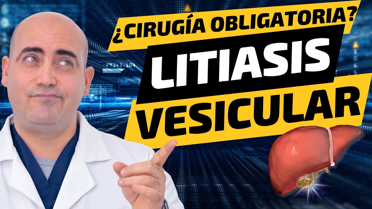 PIEDRAS EN LA VESÍCULA: ¿Se pueden disolver los cálculos biliares? ¿O solo cirugía de vesícula?