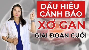 7 dấu hiệu cảnh báo xơ gan giai đoạn cuối | Dược Sĩ Hiếu