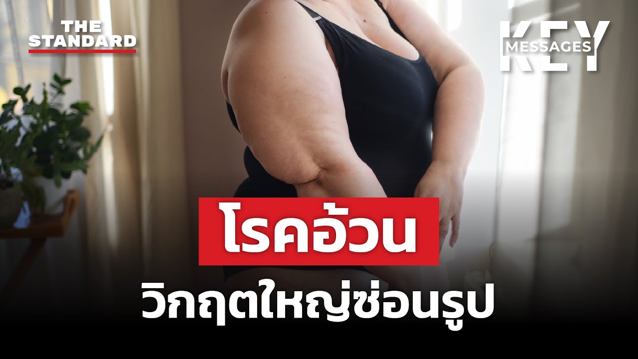 วิกฤตโรคอ้วน ภัยคุกคามต่อสุขภาพคนทั่วโลก | KEY MESSAGES 