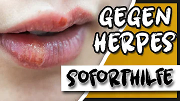 Was hilft am schnellsten gegen Lippenherpes?