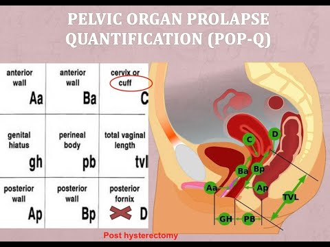 POP Q Classification system part 1