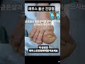 #내성발톱 #IngrownToenail #ToenailCare #FootCare #NailCare #FootHealth #巻き爪 #陥入爪 #MongQuap #ChamSocChan