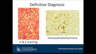 Creutzfeldt-Jakob Disease and Other Prion Diseases