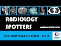 Radiology spotters musculoskeletal system set 2 with discussion