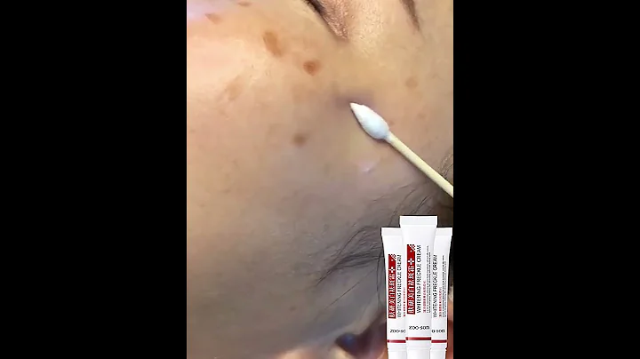Freckle removal cream, easy to remove stubborn freckles, effective in 7 days#Shorts - DayDayNews