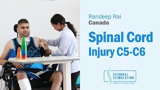 Canadian C5-C6 Spinal Cord Injury Patient Randeep's Road to Recovery After Epidural Stimulation