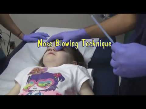 Nasal Foreign Body Removal Techniques