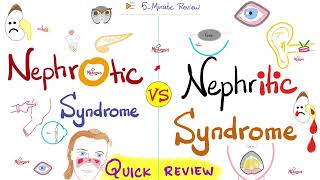Nephrotic And Nephritic Syndrome Quick Review Nephrology Pathology