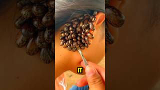 Why Yanking a Tick Off Is The Worst Move😱