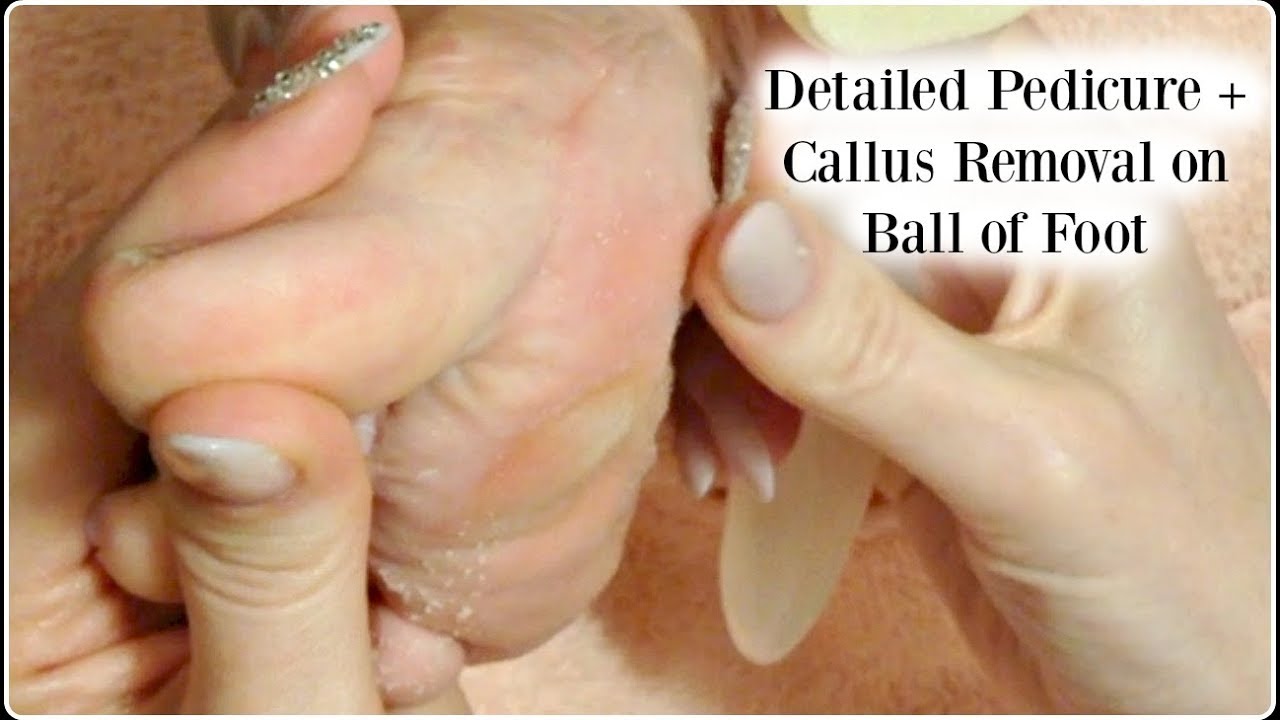 👣 Pedicure Tutorial Callus Removal on Ball of Foot and Foot