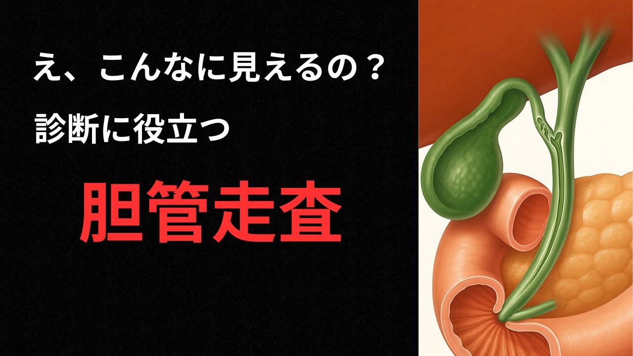 【エコー検査】胆管走査の基本を完全解説！走査手順をエコー画像でわかりやすく解説