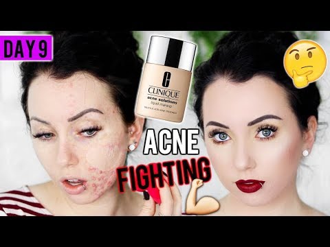 Video: Clinique Acne Solutions Powder Makeup Review