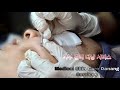 [ FULL SERVICES ]스킨 케어 ASMR Let Me In Spa Medical Skin Care Danang Services.