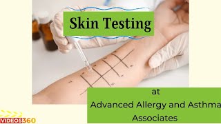 Skin testing done at Advanced Allergy and Asthma Associates explained by Dr. Noga Askenazi