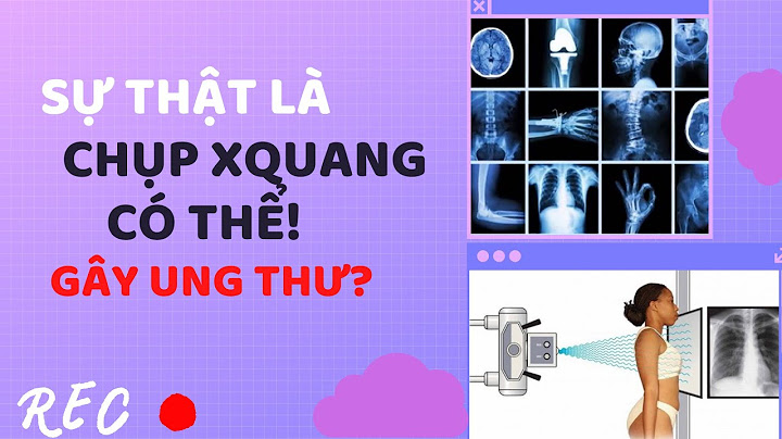 Chụp x quang đầu hết bao nhiêu tiền