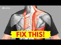 How to Fix Muscle Pain Between Your Shoulder Blades for Good