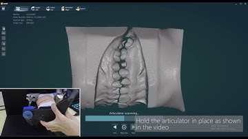 how to scan virtual occlusion with UP300+