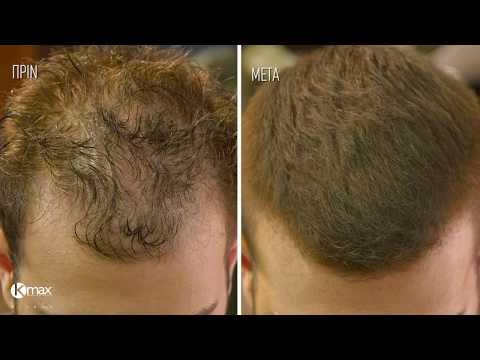👉HAIRCUT TUTORIAL! Πώς να "εξαφανίσεις" την αραίωση των μαλλιών με σωστό κούρεμα & KMax Milano