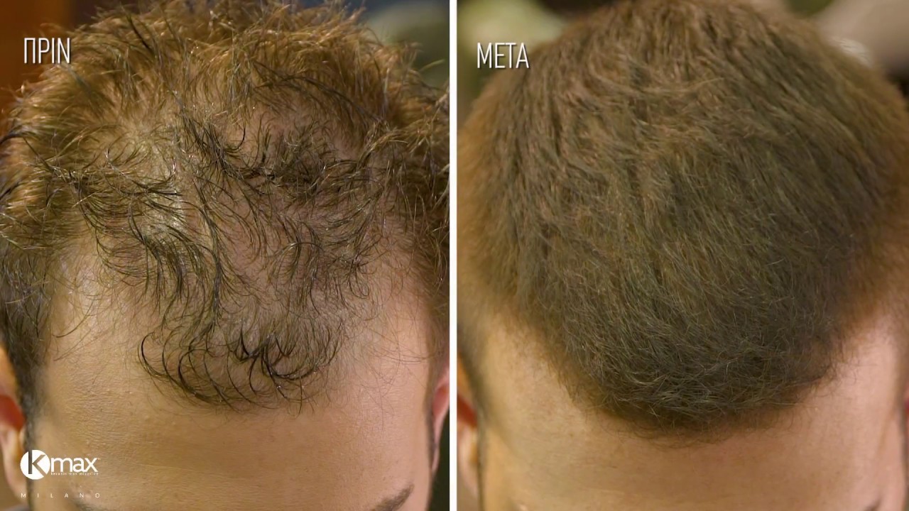 👉HAIRCUT TUTORIAL! Πώς να "εξαφανίσεις" την αραίωση των μαλλιών με σωστό κούρεμα & KMax Milano